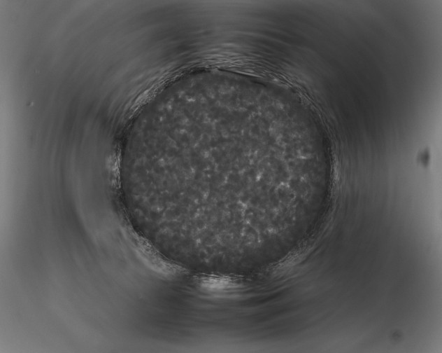 X0000115720177200912031559