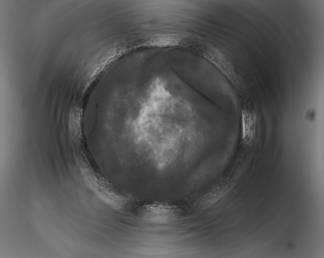 X0000115720300200912031556
