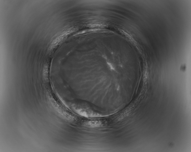 X0000115720353200912031556
