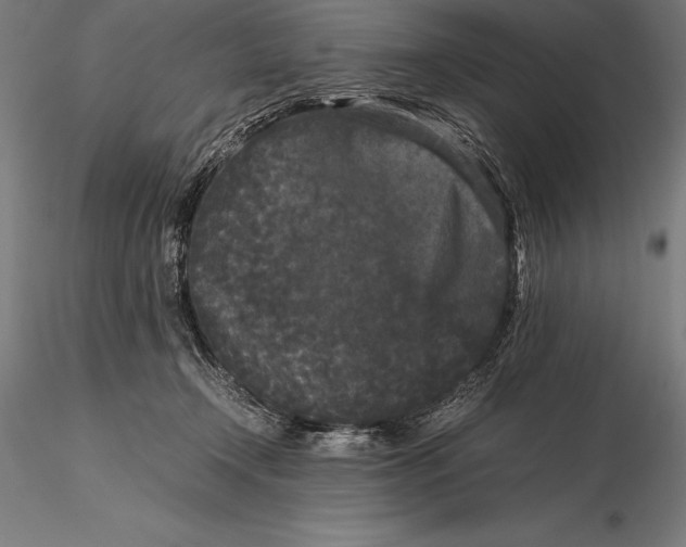 X0000115720366200912031556