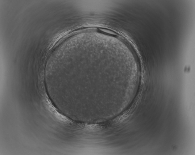 X0000115720385200912031555