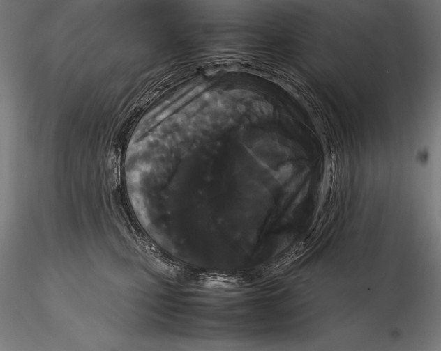 X0000115720471200912031554