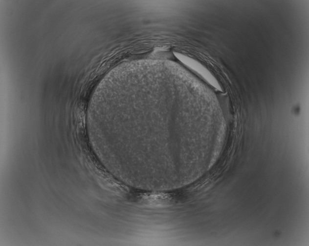 X0000115720517200912031553
