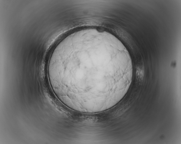 X0000115720676200912031551