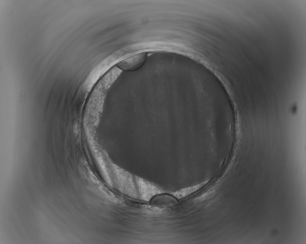 X0000115721529200912031539