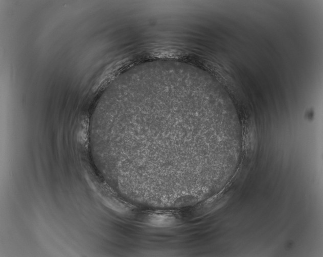 X0000115720175200912101437