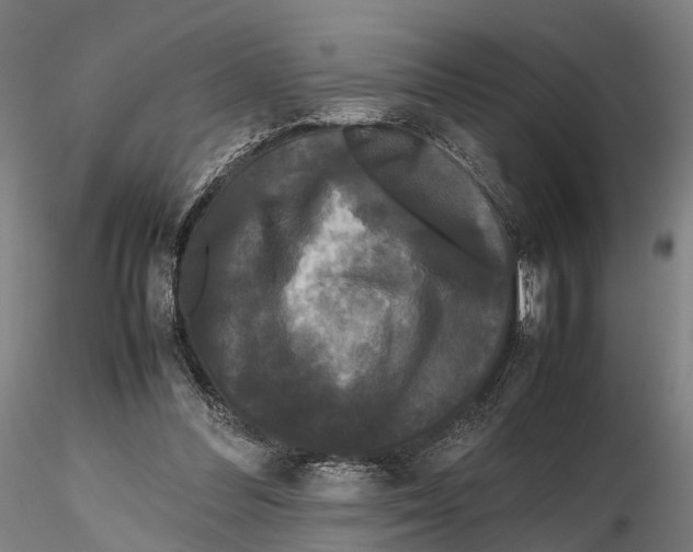 X0000115720300200912101434