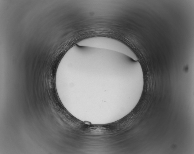 X0000115720316200912101434