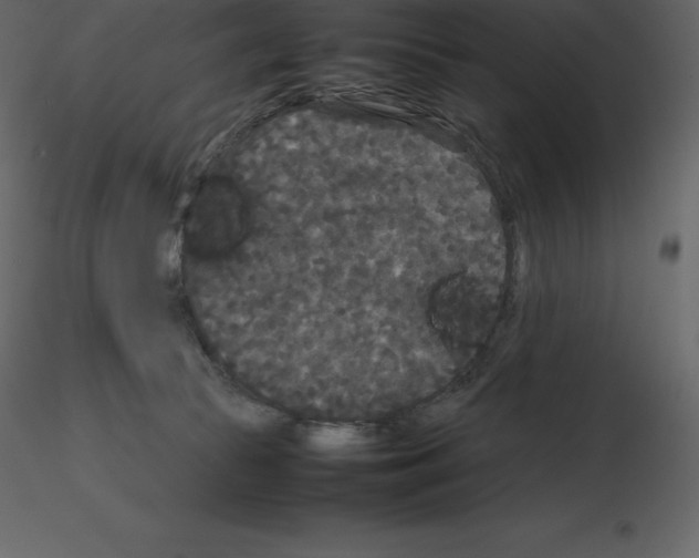X0000115720177200912241612
