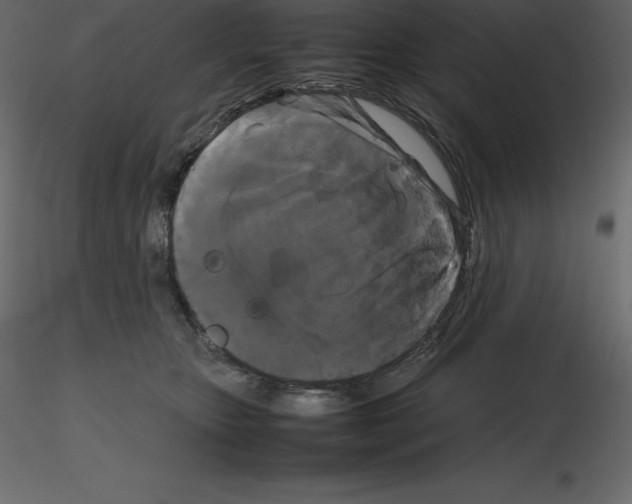 X0000115720467200912241608