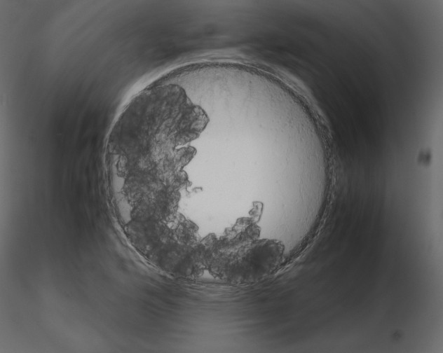 X0000115721176200912241558