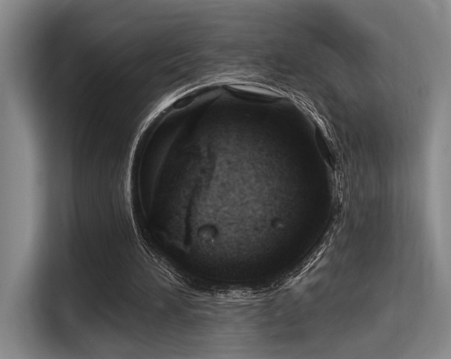 X0000115730196200911191419