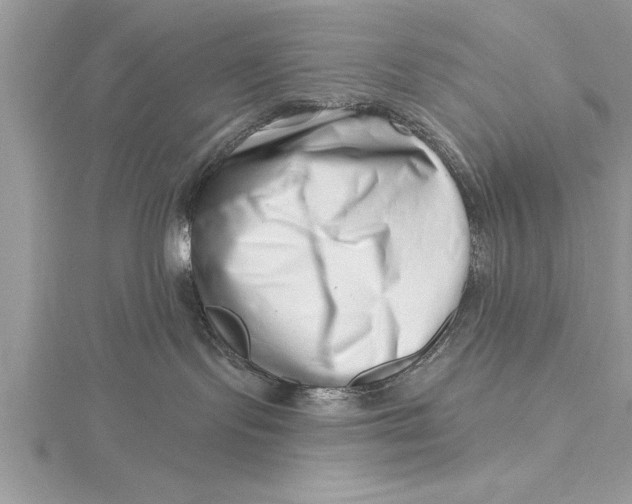 X0000115730095200912031415