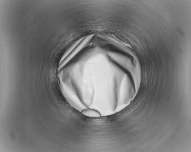 X0000115730236200912031413