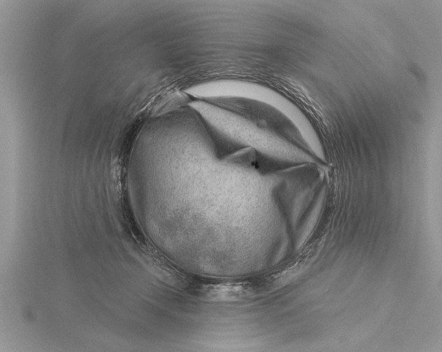 X0000115730366200912031411