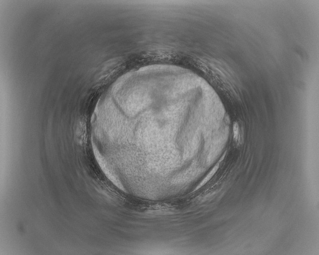 X0000115731203200912031359