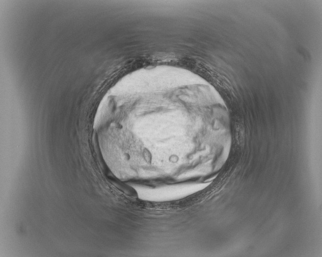 X0000115731393200912031356