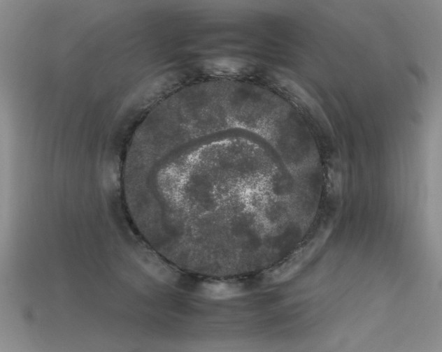 X0000115740561200911121539