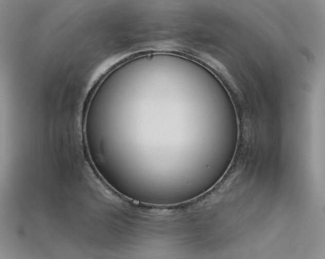 X0000115741176200911121531