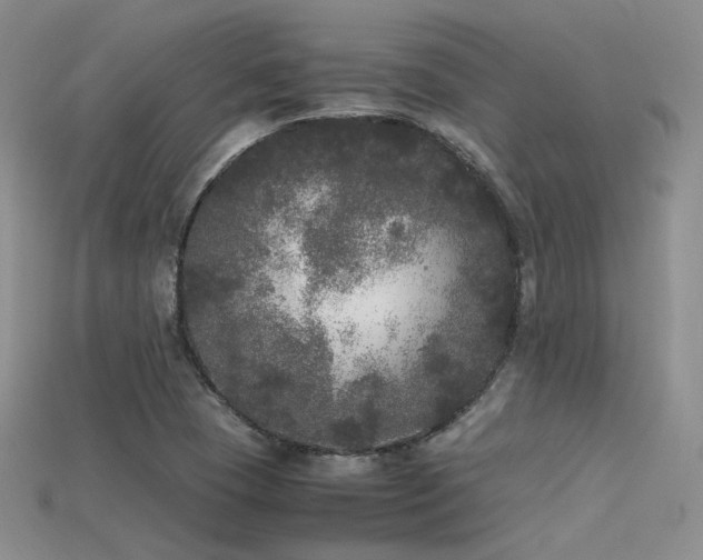 X0000115741409200911121528