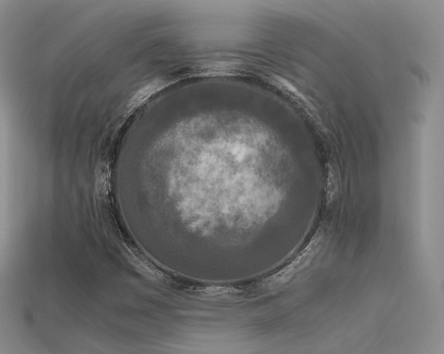 X0000115741449200911121528