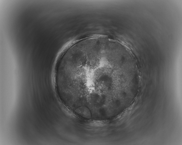 X0000115740149200911191452