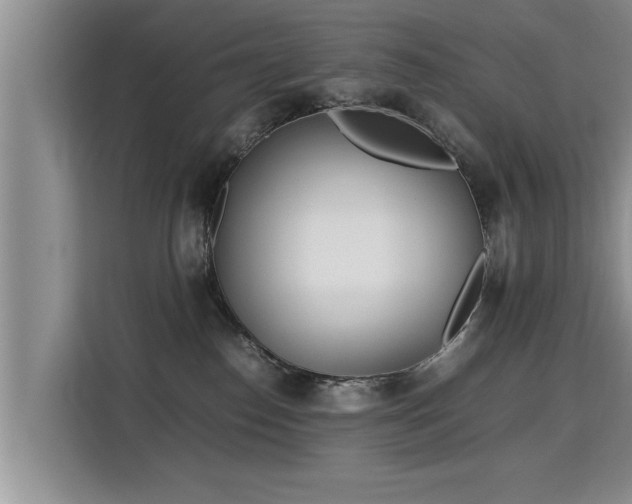 X0000115740186200911191452