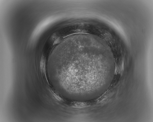 X0000115740195200911191452