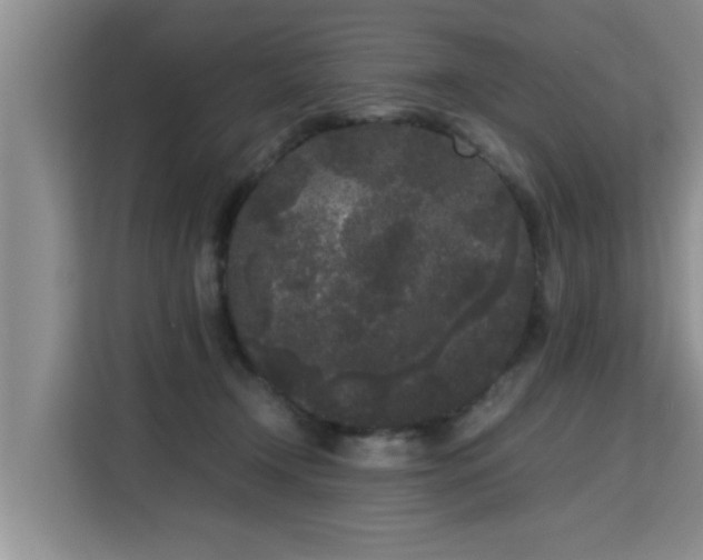 X0000115740366200911191450