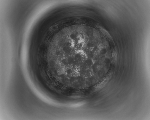 X0000115740765200911191445