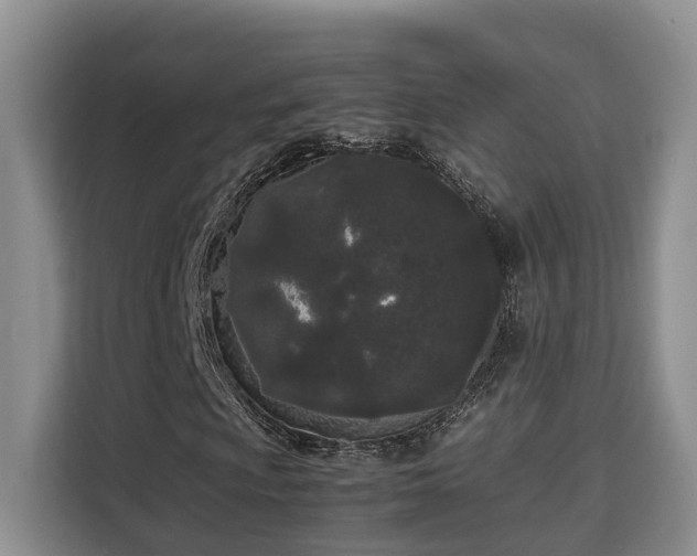 X0000115741009200911191441