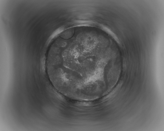 X0000115741411200911191436