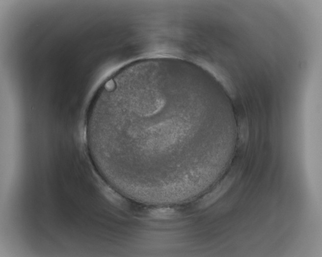 X0000115741462200911191435