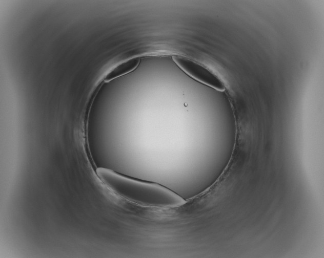 X0000115741476200911191435