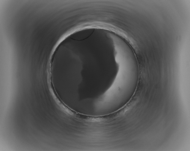 X0000115741522200911191435