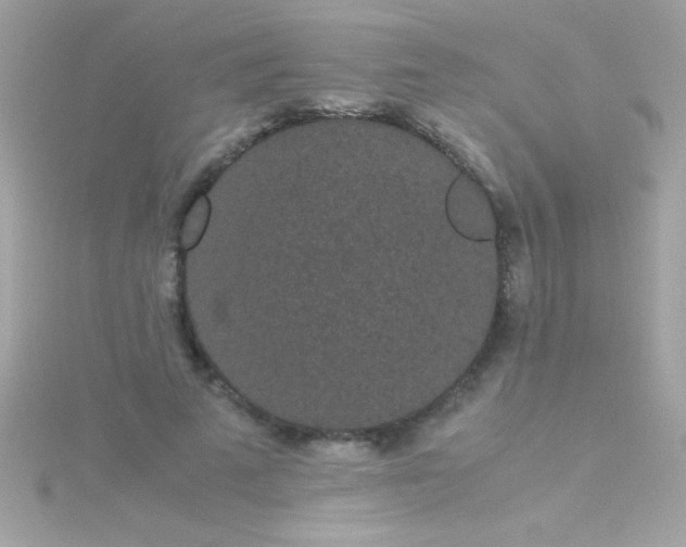 X0000115740689200911252000