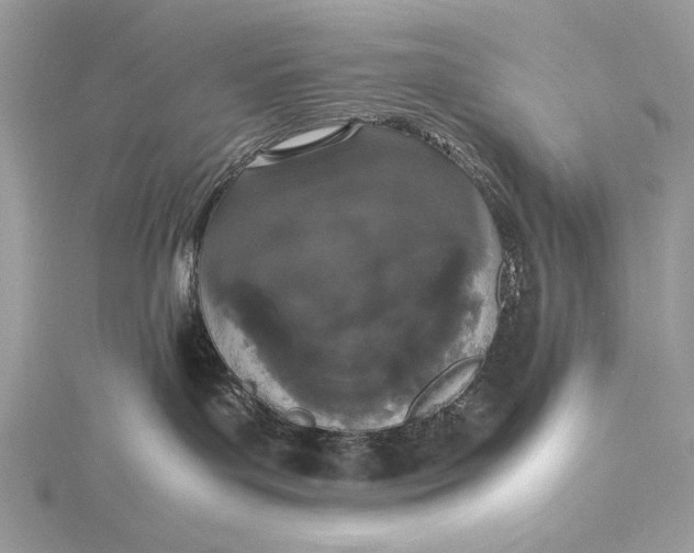 X0000115740143200912031435