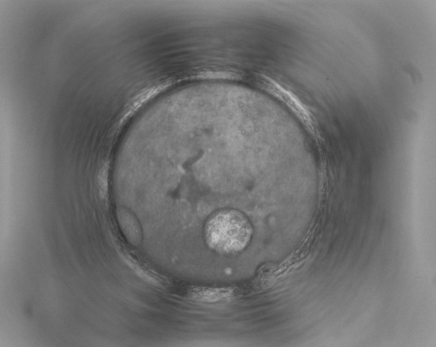 X0000115740155200912031434