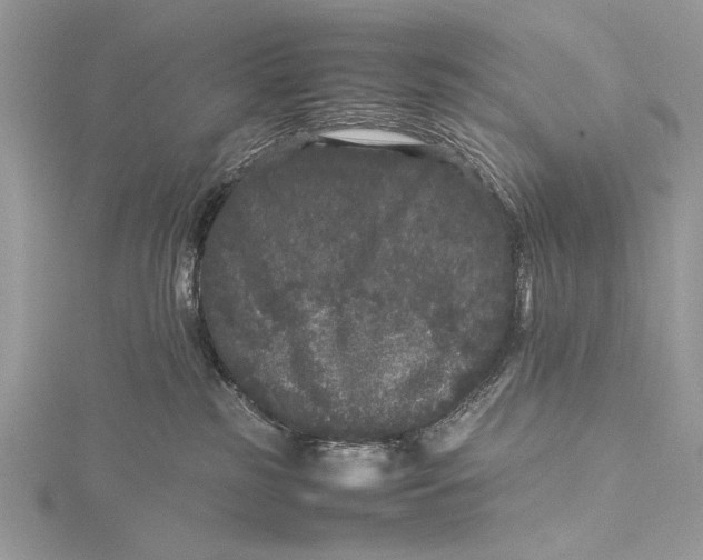 X0000115740185200912031435