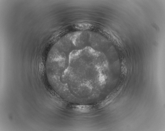 X0000115740371200912031432