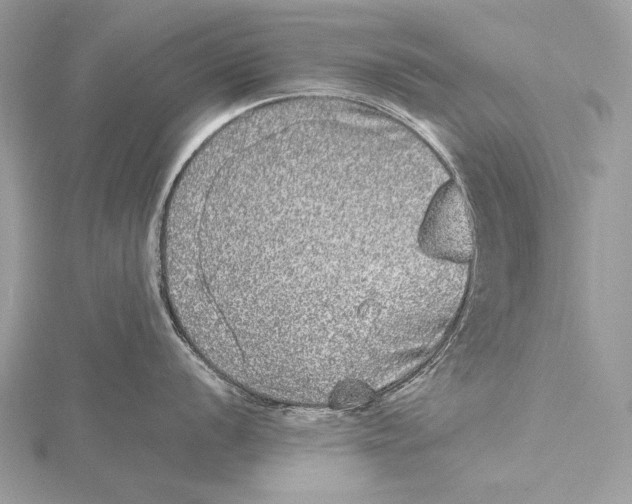 X0000115741056200912031423