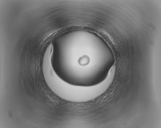 X0000115741064200912031423