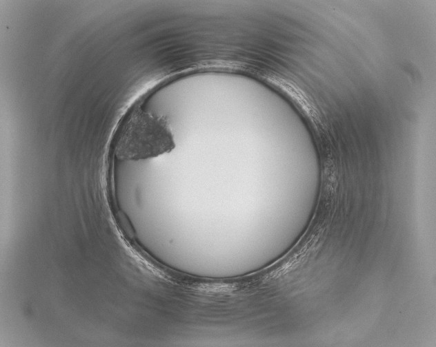 X0000115741135200912031422