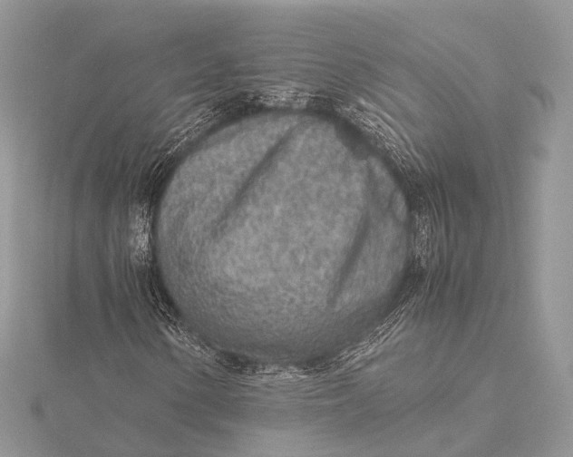 X0000115741154200912031421