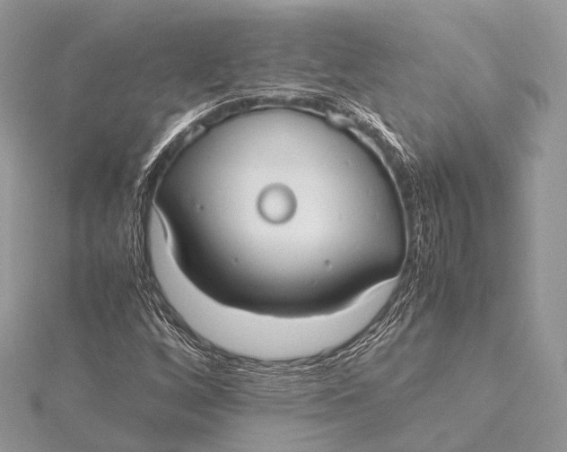 X0000115741256200912031420