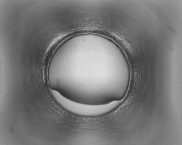 X0000115741262200912031420