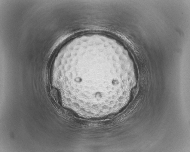 X0000115741271200912031420