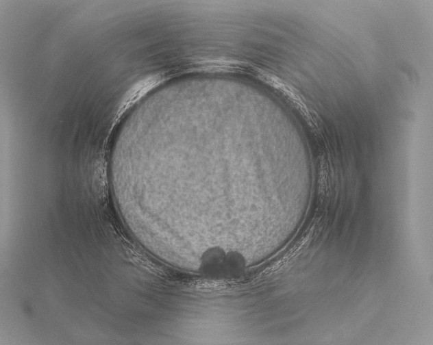 X0000115741362200912031419