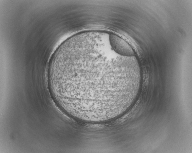 X0000115741382200912031418