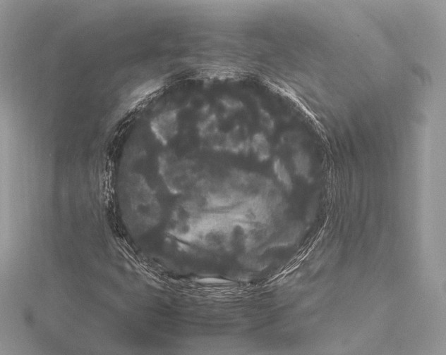 X0000115741399200912031417